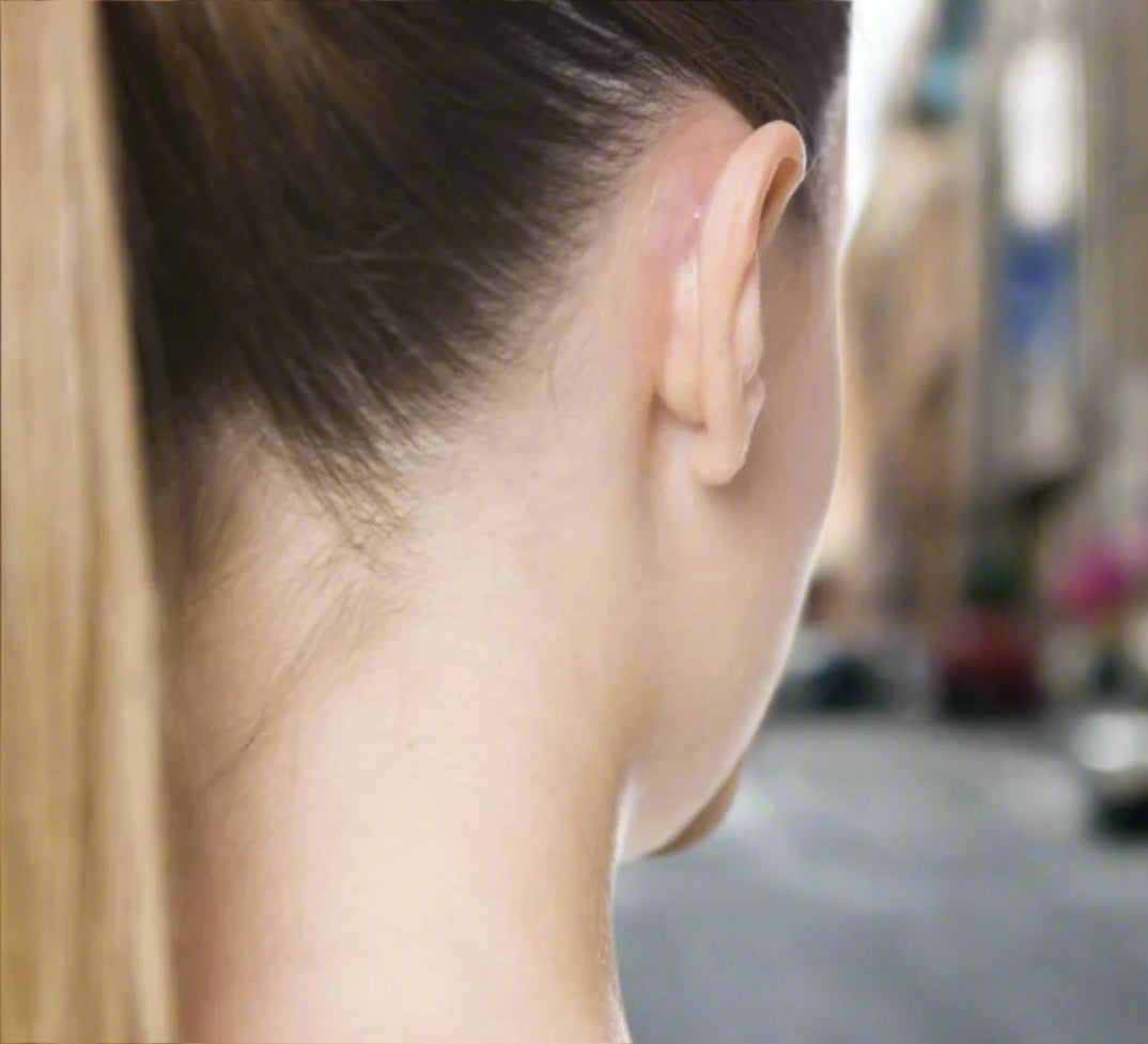 Ear Patch Corrector